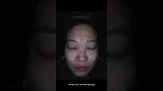 AI Skin analyzer training video