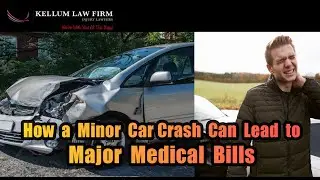 Why Even Minor Car Accidents Deserve Attention - Car Accident Personal Injury Claims.