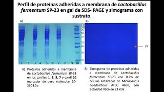 S2-BCA14 Identificaci&oacute;n de hidrolasas peptidoglucano producidas por bacterias &aacute;cido l&aacute;cticas.