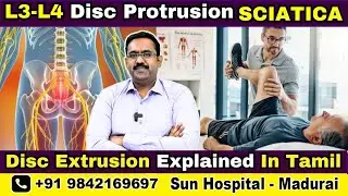 L3-L4 Disc Protrusion Sciatica வலி? Disc Extrusion காரணம் Explain Tamil | Sun Physio Hospital