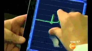 AirStrip CARDIOLOGY piloted in South Florida