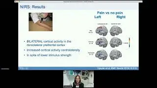 Session 4B, Claudia Sommer and End: Scottish Pain Research Community 2021 Annual Scientific Meeting