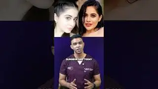 What plastic surgeries have Urfi Javed undergone?