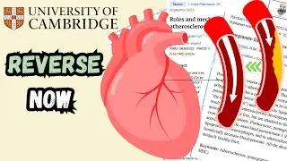 3 NATURAL Remedies that Can REVERSE Atherosclerosis by a Cambridge Doctor