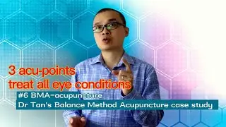 #6 BMA-acupuncture 3 acu-points to treat all eye conditions-Dr Tan's Balance Method Acupuncture