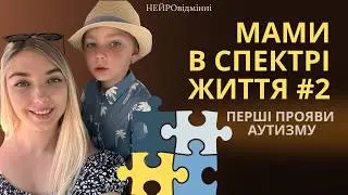 Перші симптоми аутизму. Історія мами нейровідмінного синочка