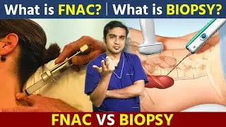FNAC vs. Biopsy: What's the Difference? All Explained By Dr. Ashank Bansal