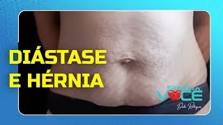 Diástase e Hérnia - Dr. Dacio Ogata