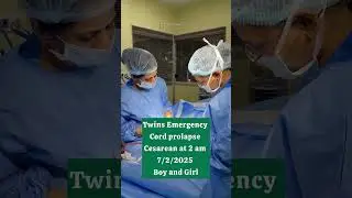 Twins at 32 weeks with cord prolapse Cesarean done at 2 am on 7/2/2025 . Great team efforts #twin