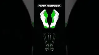 Tipos de Pisada