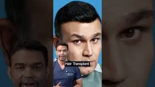 Patch or Permanent? Unpacking the Truth About Cricketers' Hair