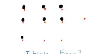 Understanding Total vs Free Phenytoin