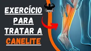 Exercício para tratar CANELITE em casa ou na academia - Canal do Personal