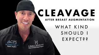 After breast augmentation, what kind of cleavage should I expect?