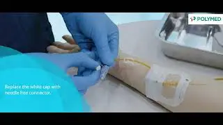 Nouvo Safety Set | Polymed