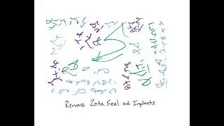 Light Language Channeling: Remove Zeta Seal and Implants