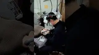 Pore Care with Starlux Laser