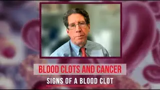 Blood Clots and Cancer Series: What are the signs of thrombosis a blood clot?