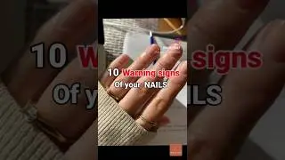 ⚠️ WARNING SIGNS OF YOUR NAILS ⚠️
