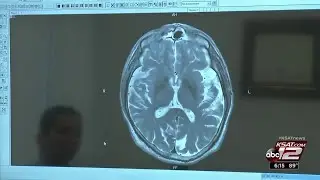 Alzheimer's risk assessment tool