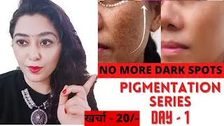 PIGMENTATION SERIES DAY-1 चेहरे के दाग धब्बे,झाइयों से छुटकारा: Remove Dark Spots,Pigmentation #glow