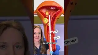 Did you learn something? #iud