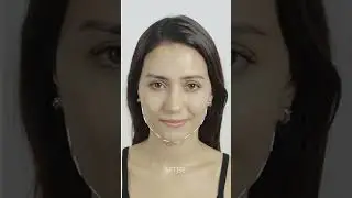 Belega Cell Cure 4T Plus [5 Minutes Face-Lift Challenge]【BeautyFoo Mall】