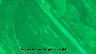 GtACR1TM6b x 24b  fibrillation in intense green light