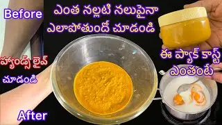 ఎంత నల్లగా ఉన్నా తెల్లగా మార్చే sun tan pack, కోటి రూపాయలు పెట్టినా దొరకదు కాక దొరకదు వాడండి చూడండి 