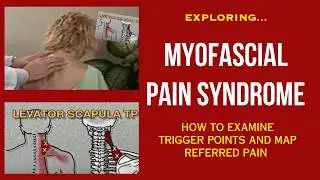 Myofascial Pain Syndrome -Trigger Point Exam