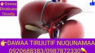 DAWAA DHUKKUBA TIRUU