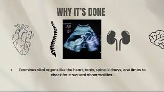 Anomaly scan