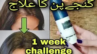 How to prevent hair loss|hair fall | pillus spray review #pillussparyreview#preventhairfall#hairloss
