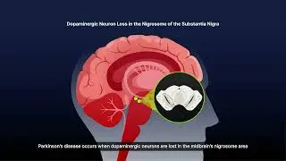 Heuron AgingCare Suite&trade;: Early Detection of Neurodegenerative Diseases with AI