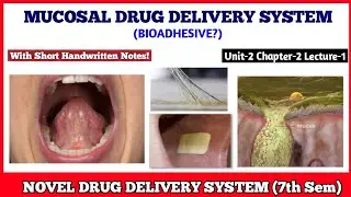 Mucoadhessive Drug Delivery System | Bioadhesive | Novel Drug Delivery System 7th semester