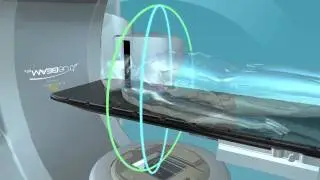 TrueBeam Beam Geometry