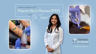 Плазма, обогащенная тромбоцитами (PRP), при выпадении волос
