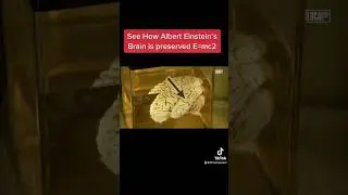 See How Albert Einstein&rsquo;s Brain is Preserved ❤️😮#shorts #youtubeshorts