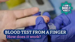 Blood Test from a Finger