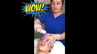 ✅ Americ Empire 😱 Пылесос для лица от черных точек Pro + Galvanic Spa Facial. 🔥 Практическое обучение