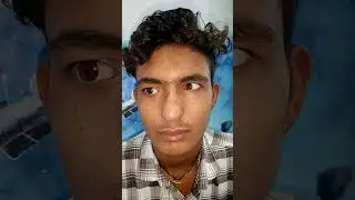 Get back your lost beauty with artificial eyes #fake_eye #artificial_eye missing eye #eyemovement