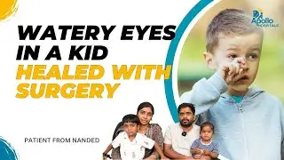 Successful Surgery Relieves Boy's Persistent Watery Eyes and Itching | Eye Problems in Children