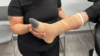 How to Apply an Unnaboot