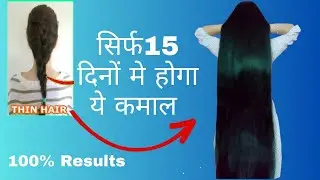 15 Days Extreme Hair Growth Challenge| Strongest Ingredient to Grow Hair Faster, Longer and Thicker