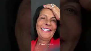 Get Perfect Hollywood Smile in Turkey #zirconiumcrowns #smilemakeoverturkey  #hollywoodsmileturkey