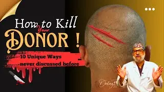 Hair Transplant in India without Side-Effects