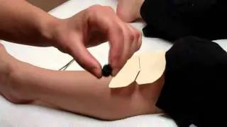 Energy Acupuncture Treatment Video