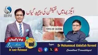Eczema & Infected Eczema Explained | Dr. Abdullah Naveed | TAWANA PAKISTAN &ndash; Shaigan Kay Sath