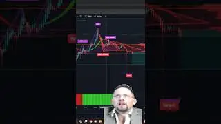 Bitcoin Head & Shoulders???👀📈 #crypto #bitcoin