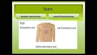 Pediatric chest examination           #pediatrics #examination #chest 